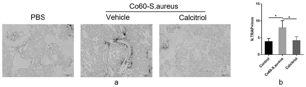 Application of vitamin D receptor stimulant in preparation of medicine for preventing and/or treating inflammatory bone loss