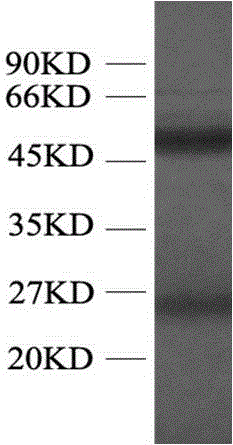 Mouse anti-human P53 monoclonal antibody and hybridoma cell strain capable of secreting monoclonal antibody