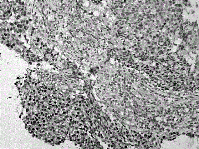 Mouse anti-human P53 monoclonal antibody and hybridoma cell strain capable of secreting monoclonal antibody