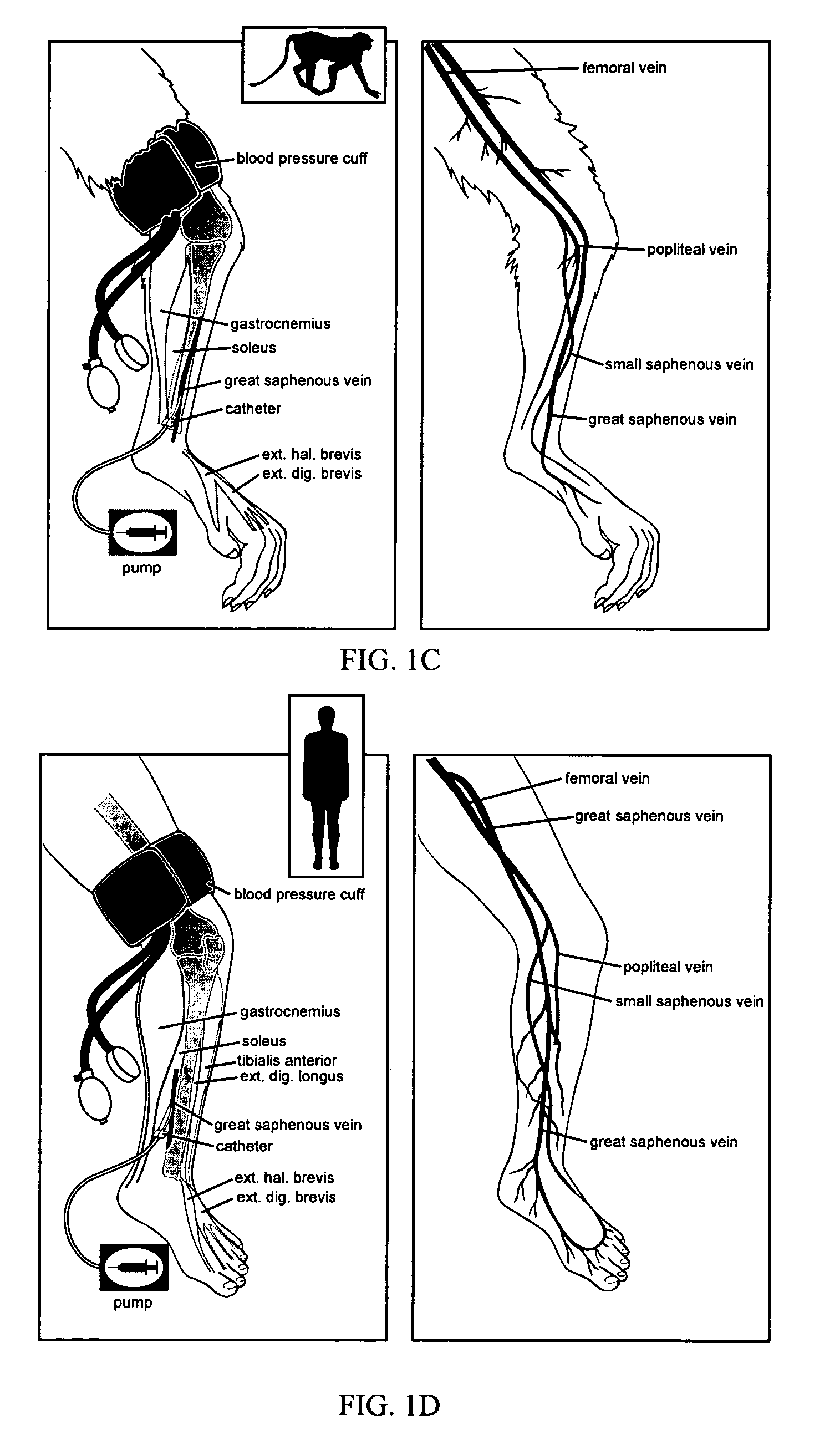 Intravascular delivery of nucleic acid