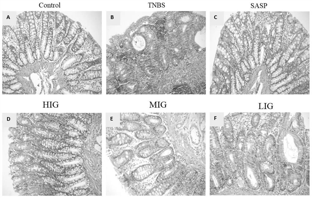 Application of fructus gardeniae extract in preparation of drugs for treating ulcerative colitis