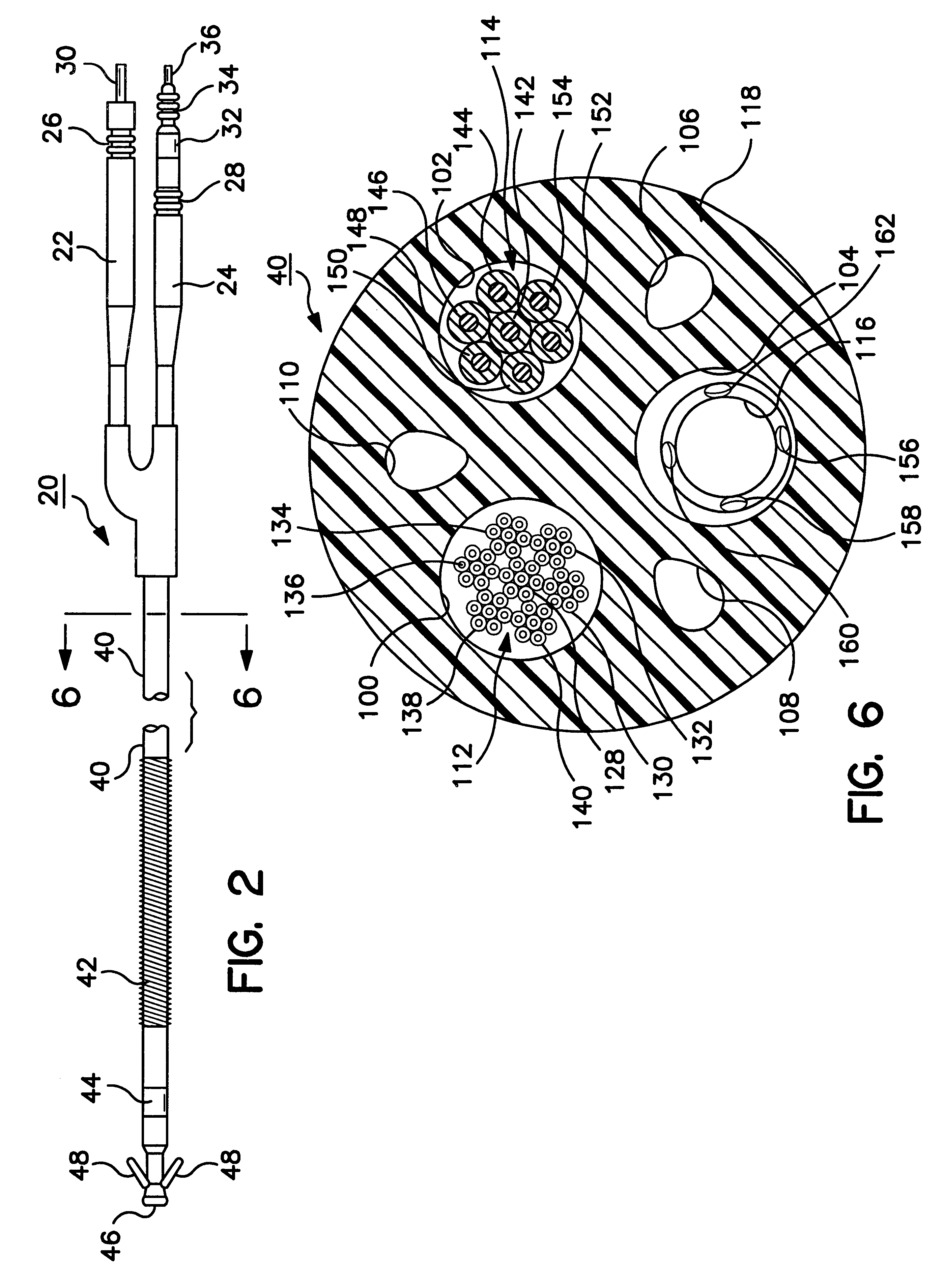 Medical lead conductor fracture visualization method and apparatus