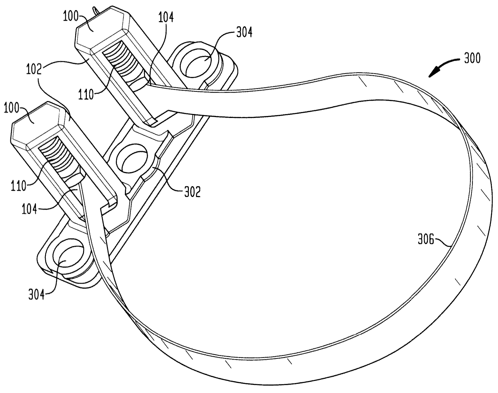 Spring Captive Loaded Fastener Retainer