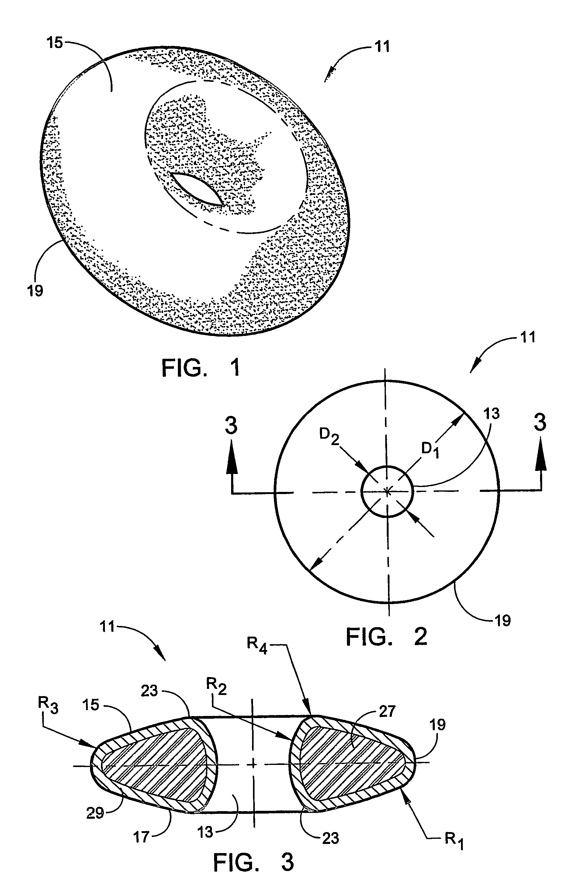 Interpositional biarticular disk implant