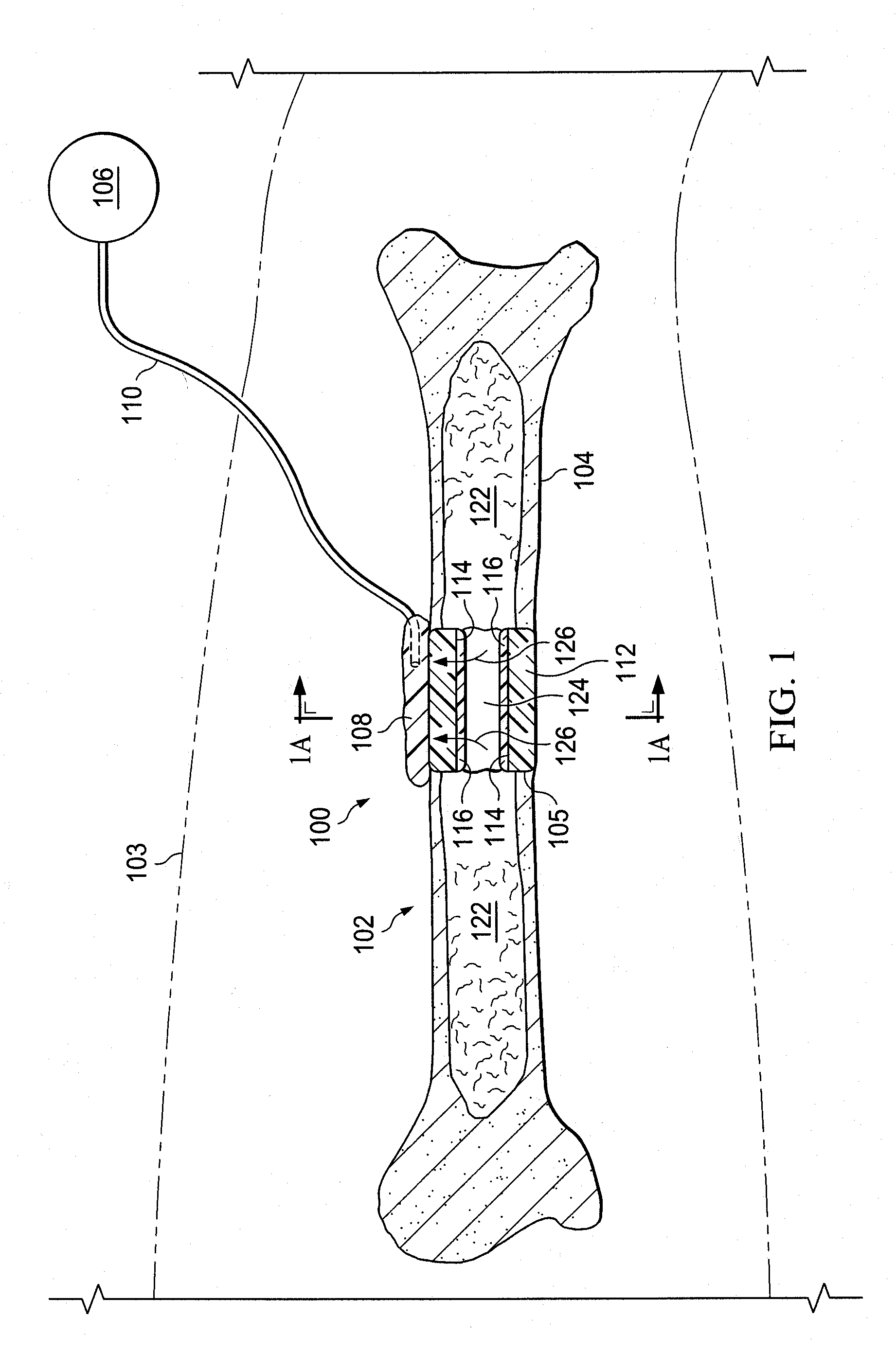Systems for providing fluid flow to tissues