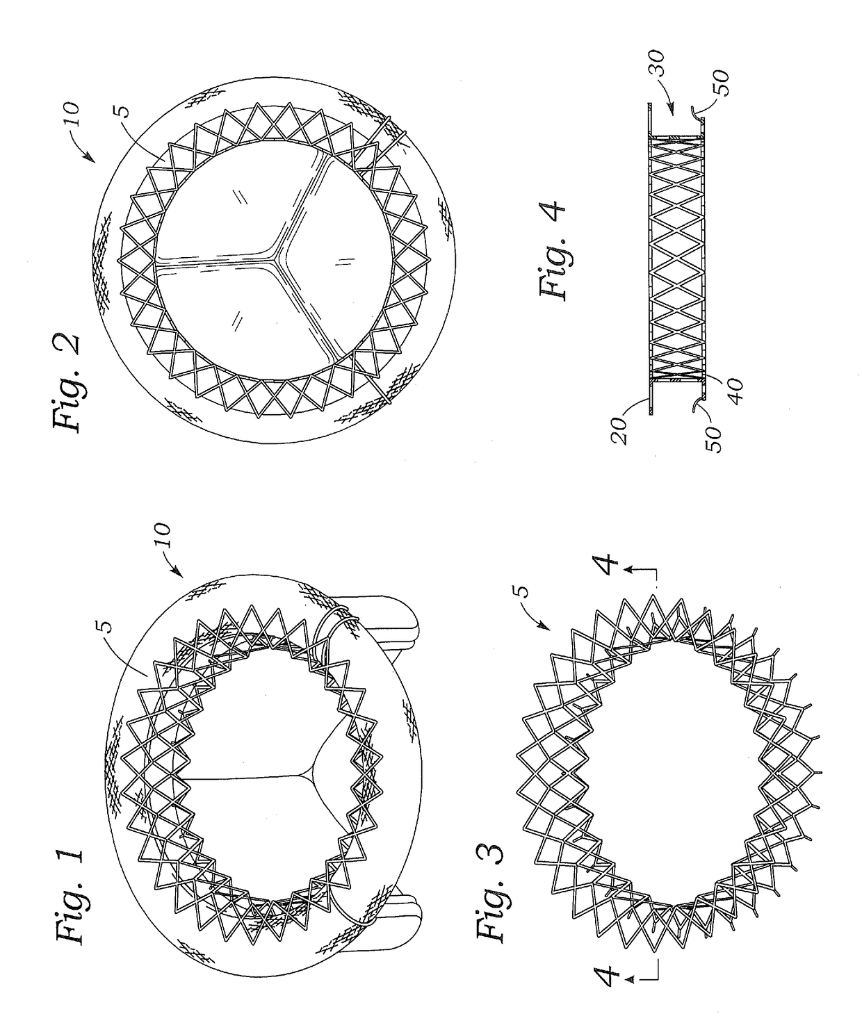 Spacer for securing a transcatheter valve to a bioprosthetic cardiac structure