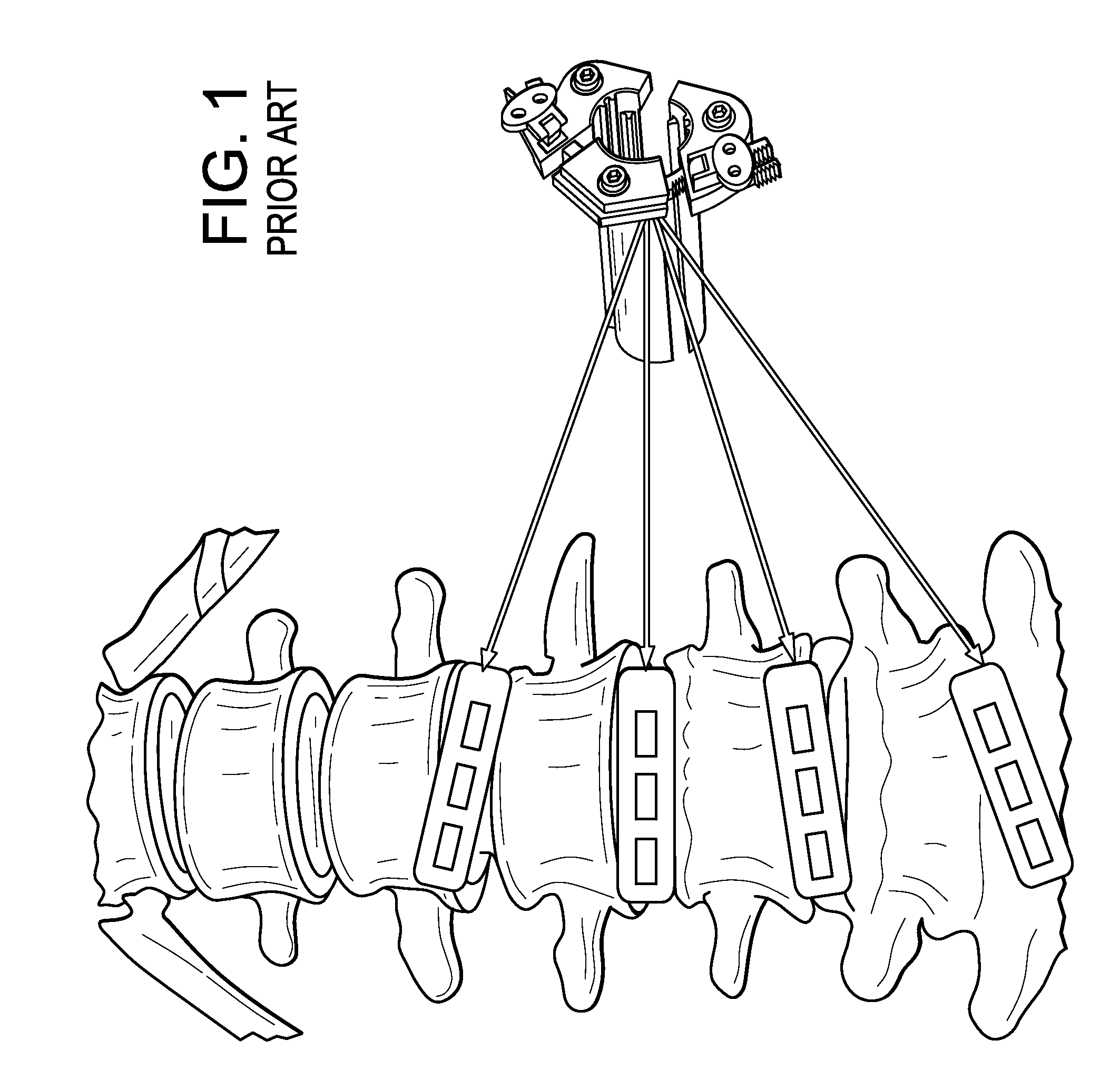 Instruments and Methods for Non-Parallel Disc Space Preparation