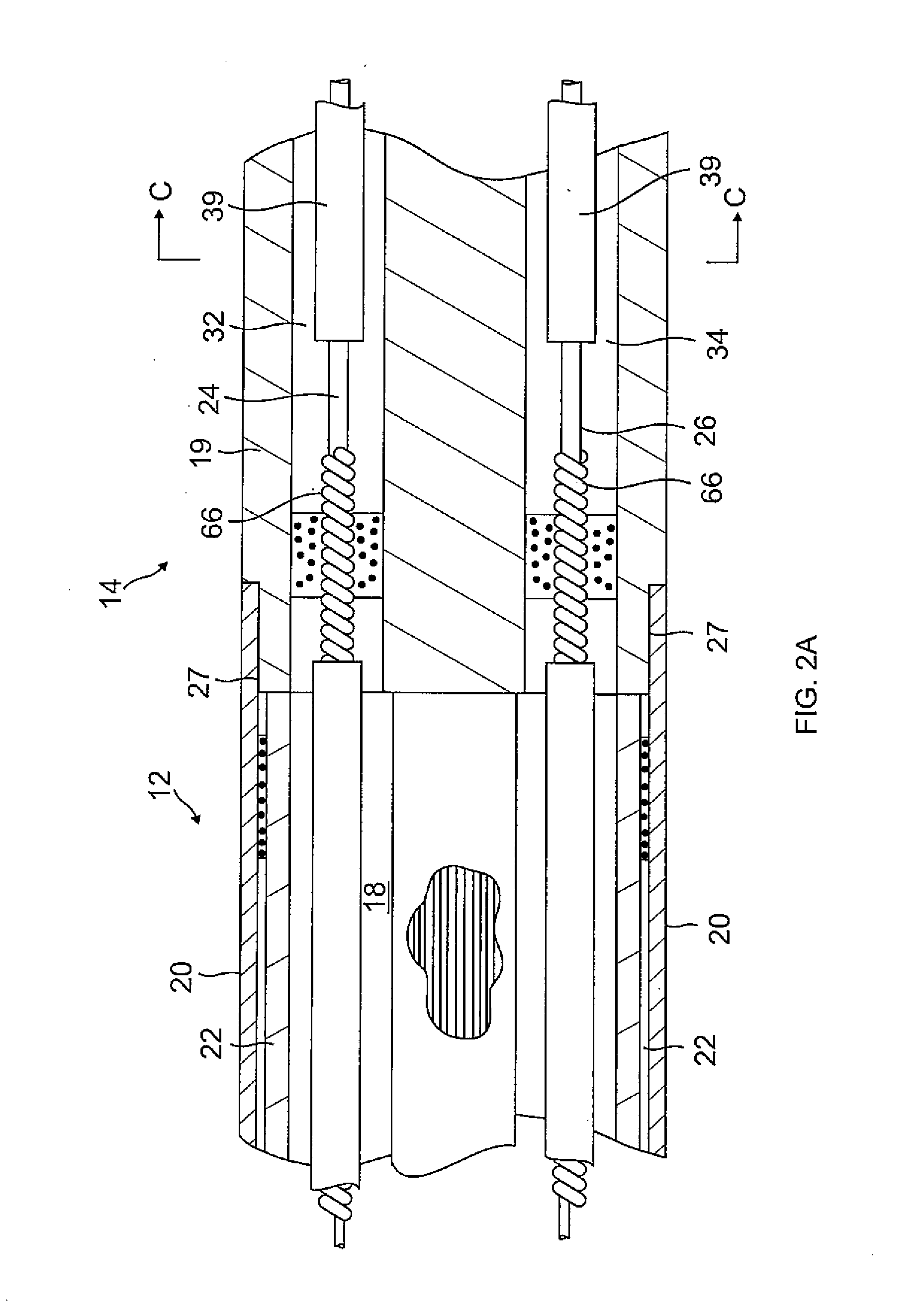Catheter with high density electrode spine array