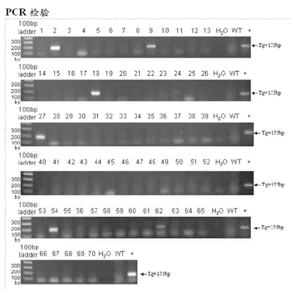 Production of hscarb2 Gene Transgenic Mice and Its Application as Animal Model of Enterovirus Infection