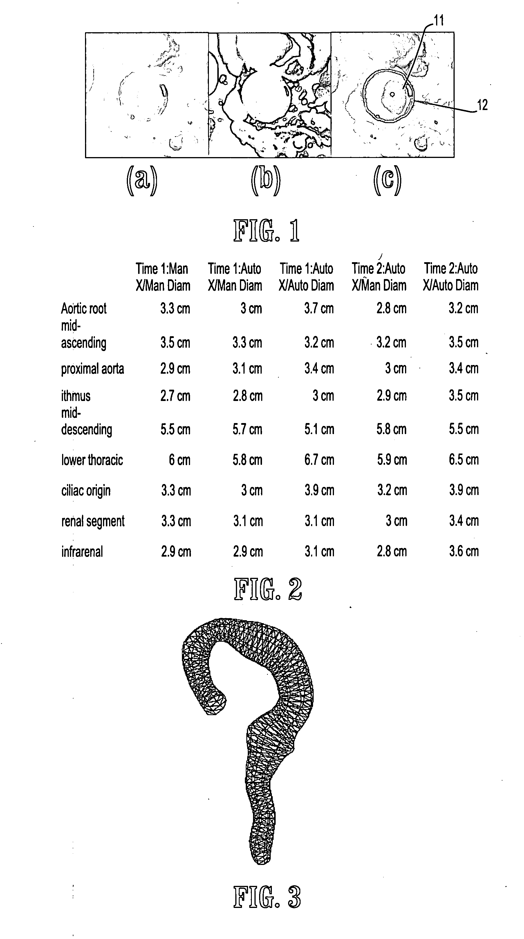 System and method for semi-automatic aortic aneurysm analysis