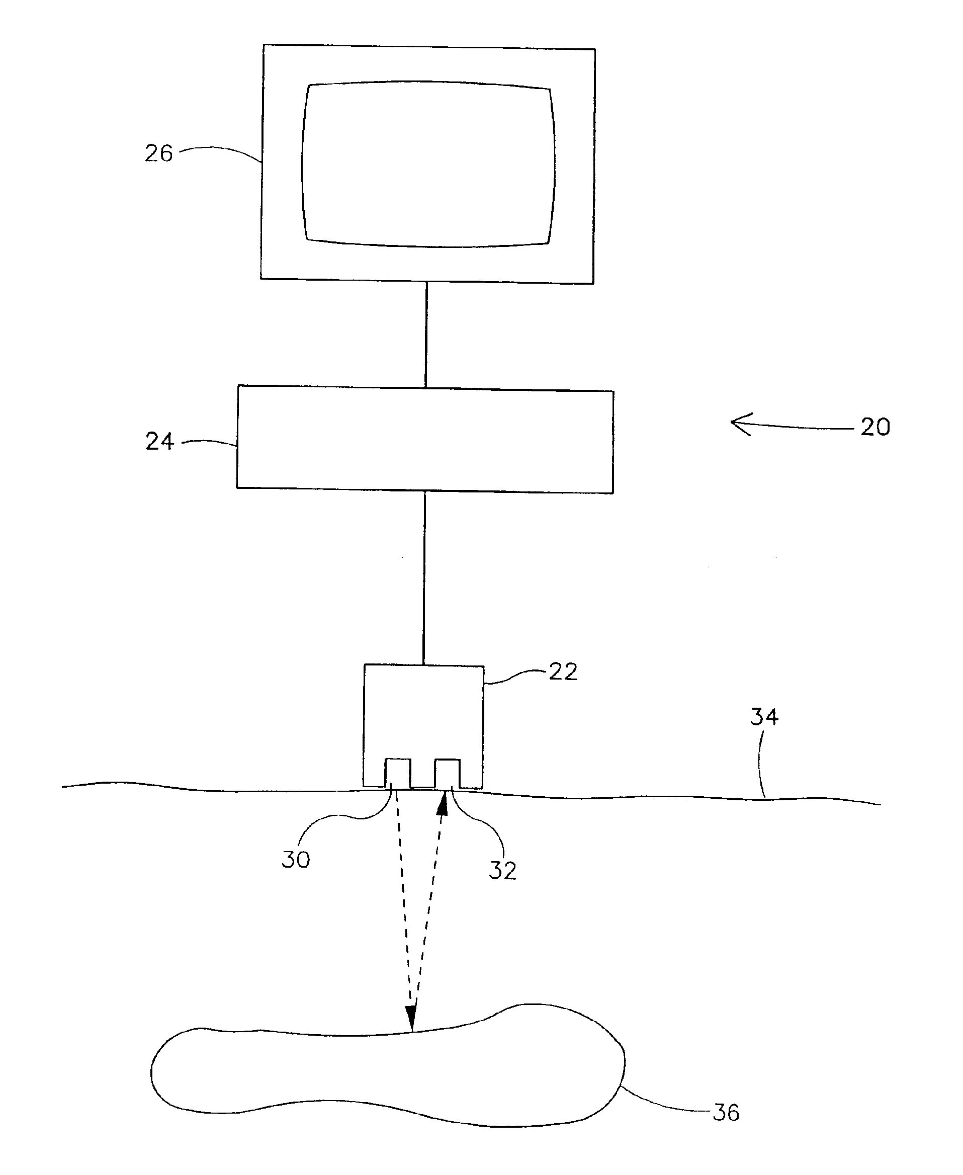 Method and apparatus for ultrasonic imaging