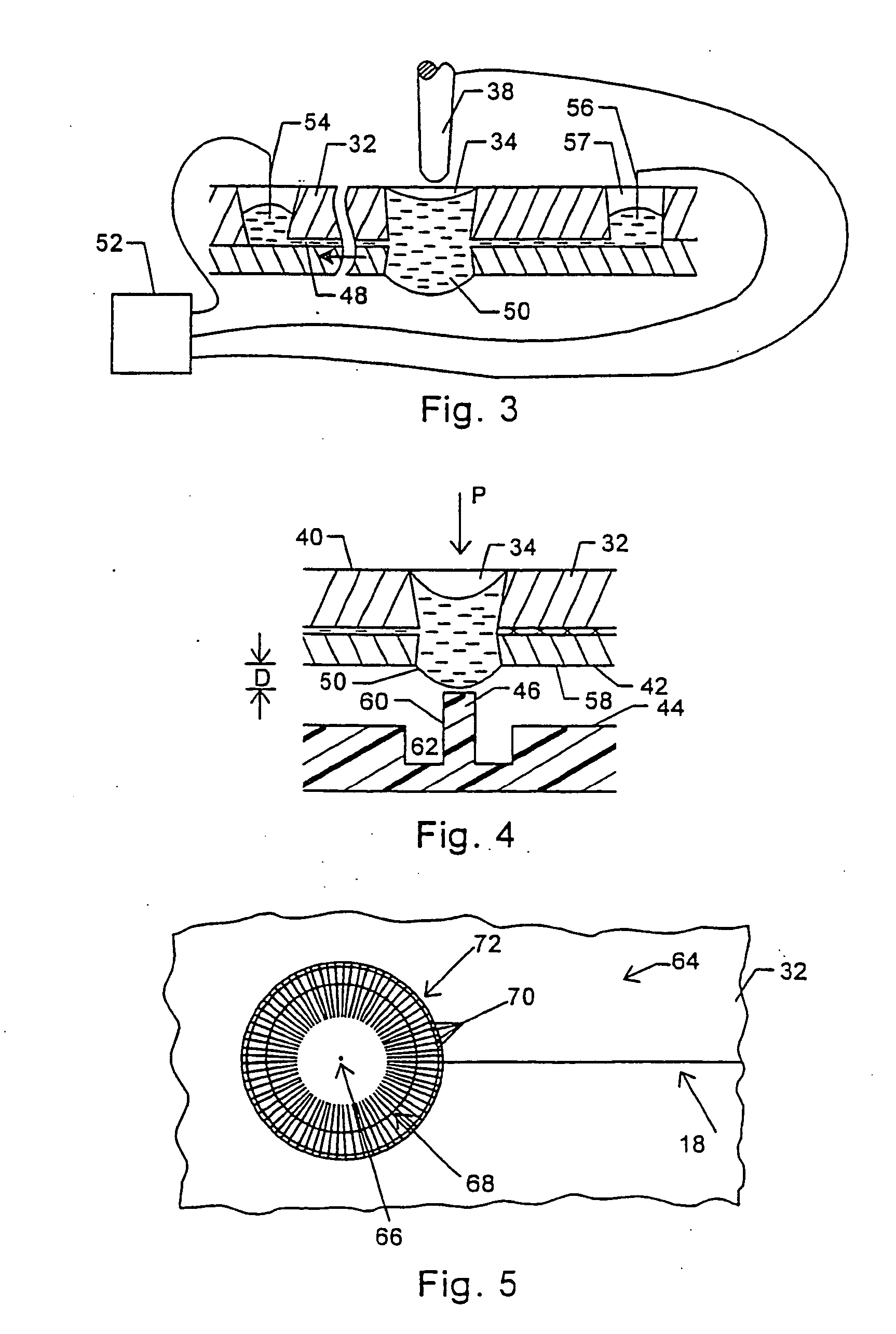 Microfabricated structures for facilitating fluid introduction into microfluidic devices