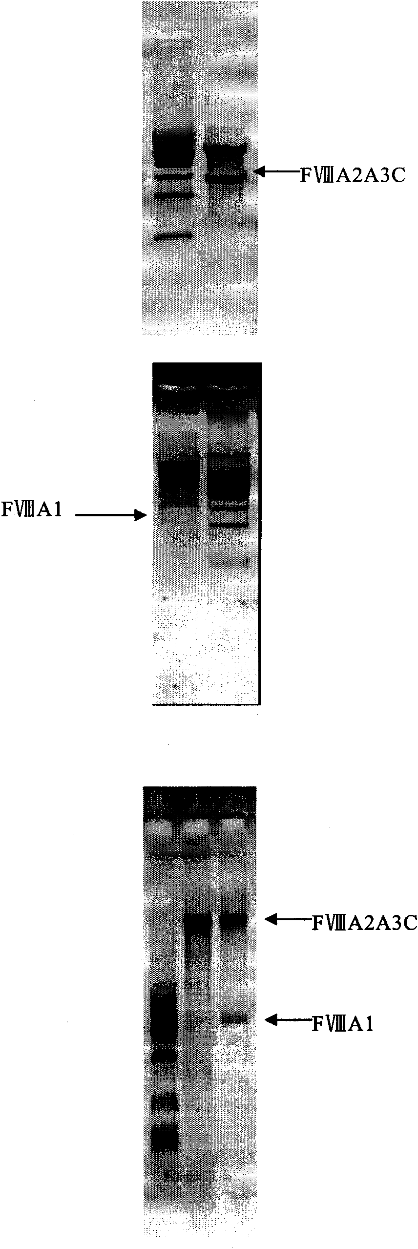 Method for expressing and producing recombinant human blood coagulation factors VIII in animal cells