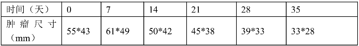 Antitumor protein and application thereof