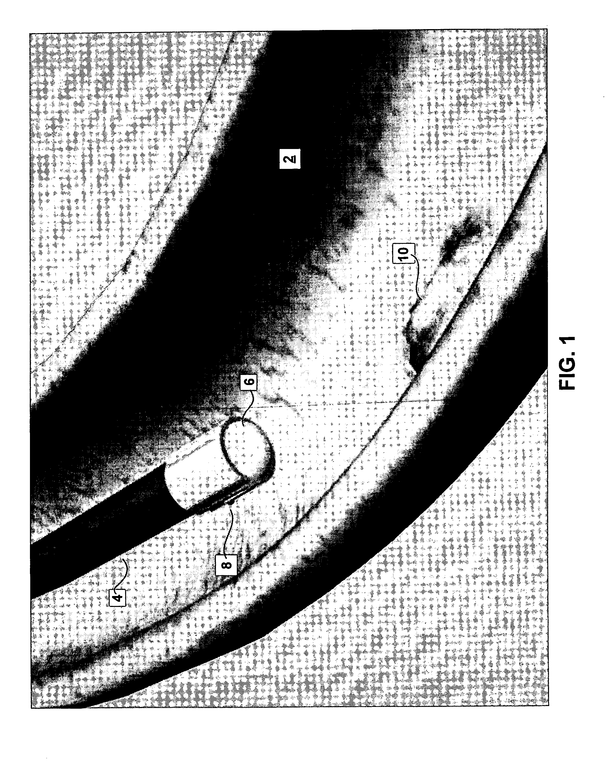 System and method for endoscopic measurement and mapping of internal organs, tumors and other objects