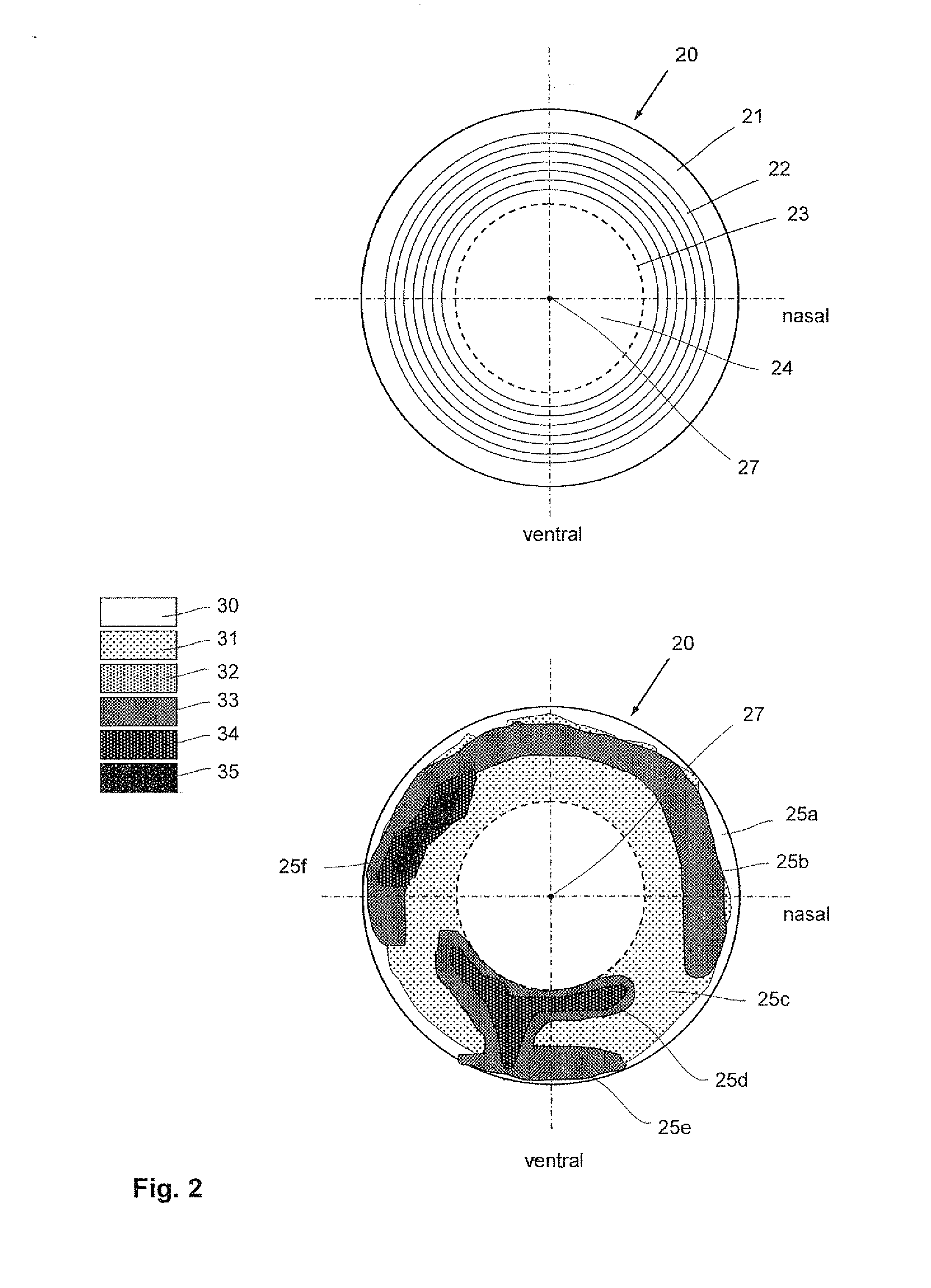 Laser therapy system and method for treatment of a collagen structure and of varicose blood vessels in an eye
