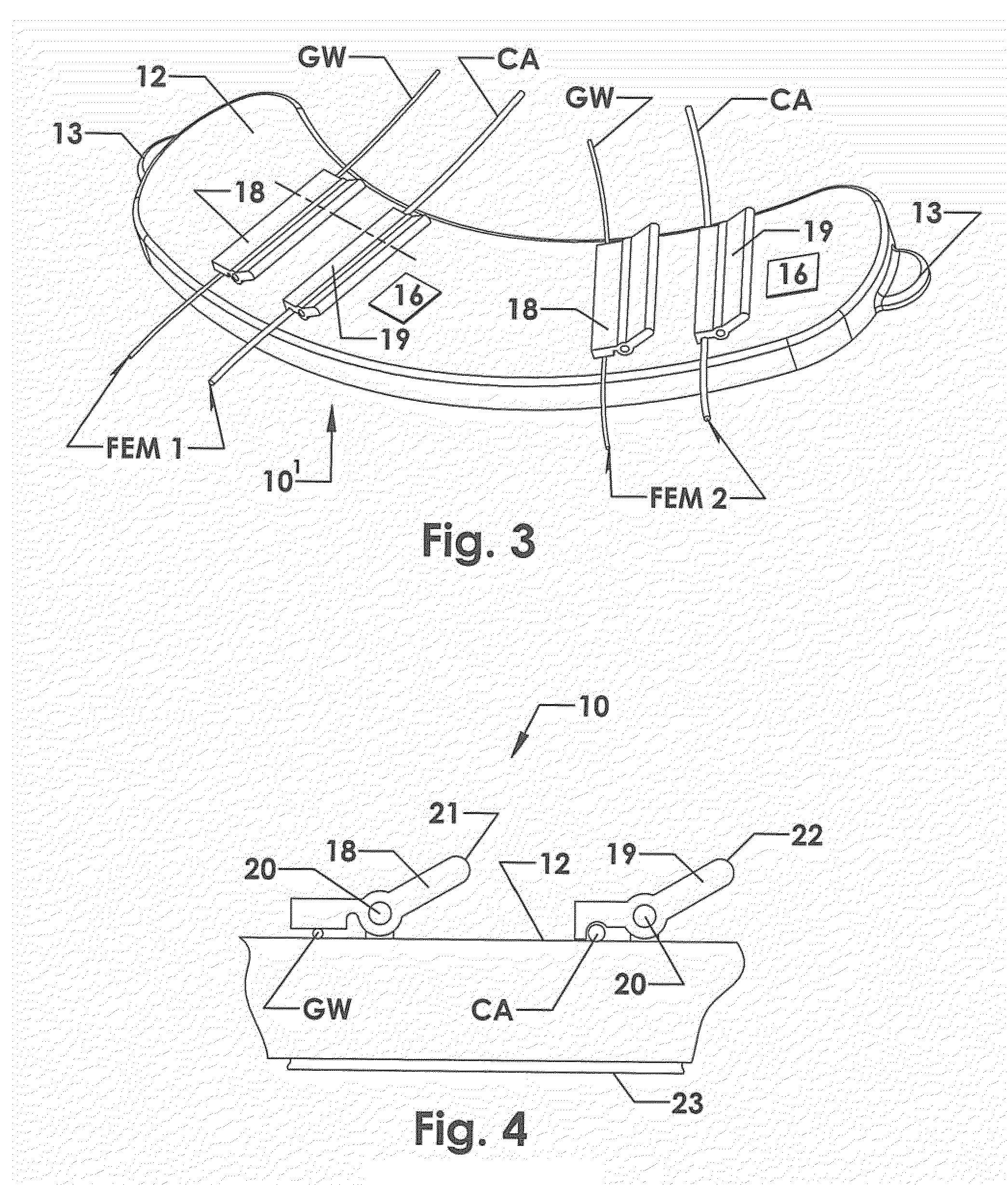 Guidewire and catheter management device