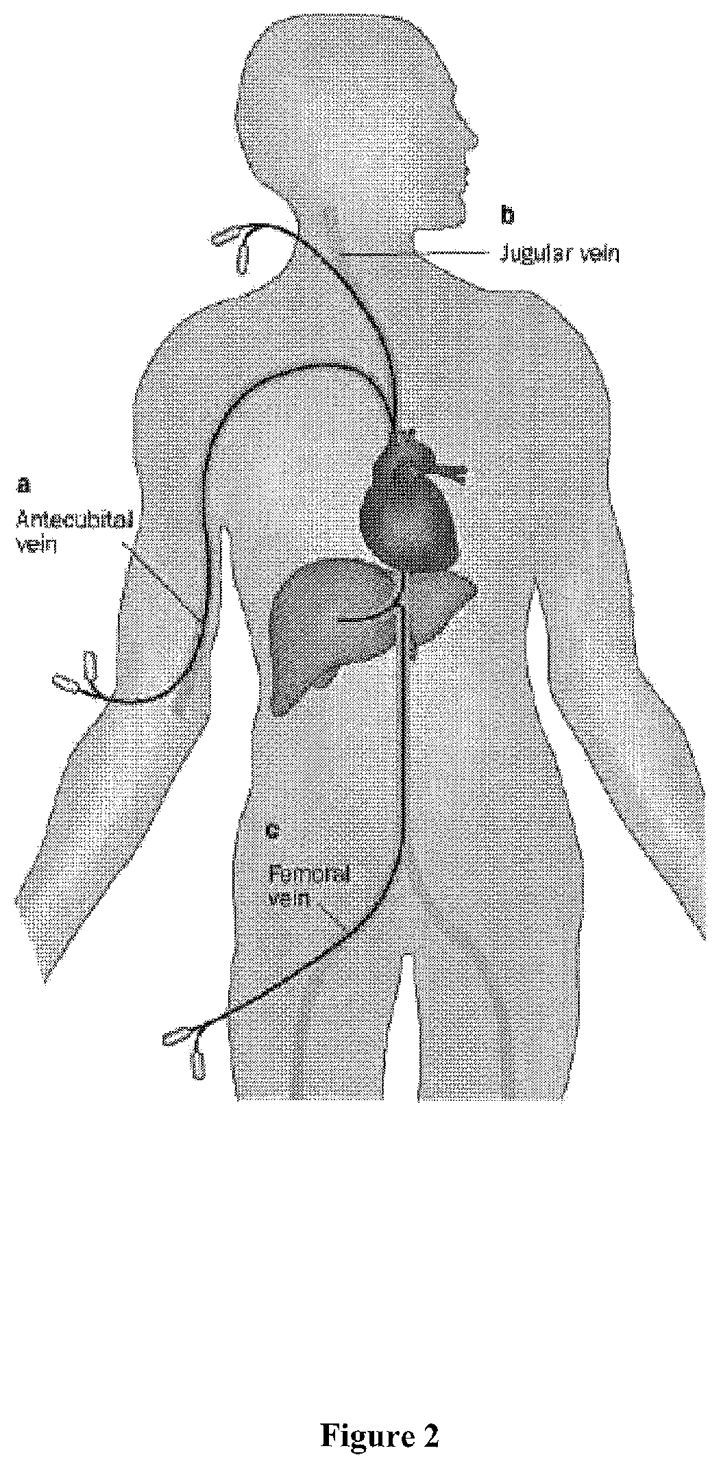 Venous access catheters and methods for portal venous system catheterization