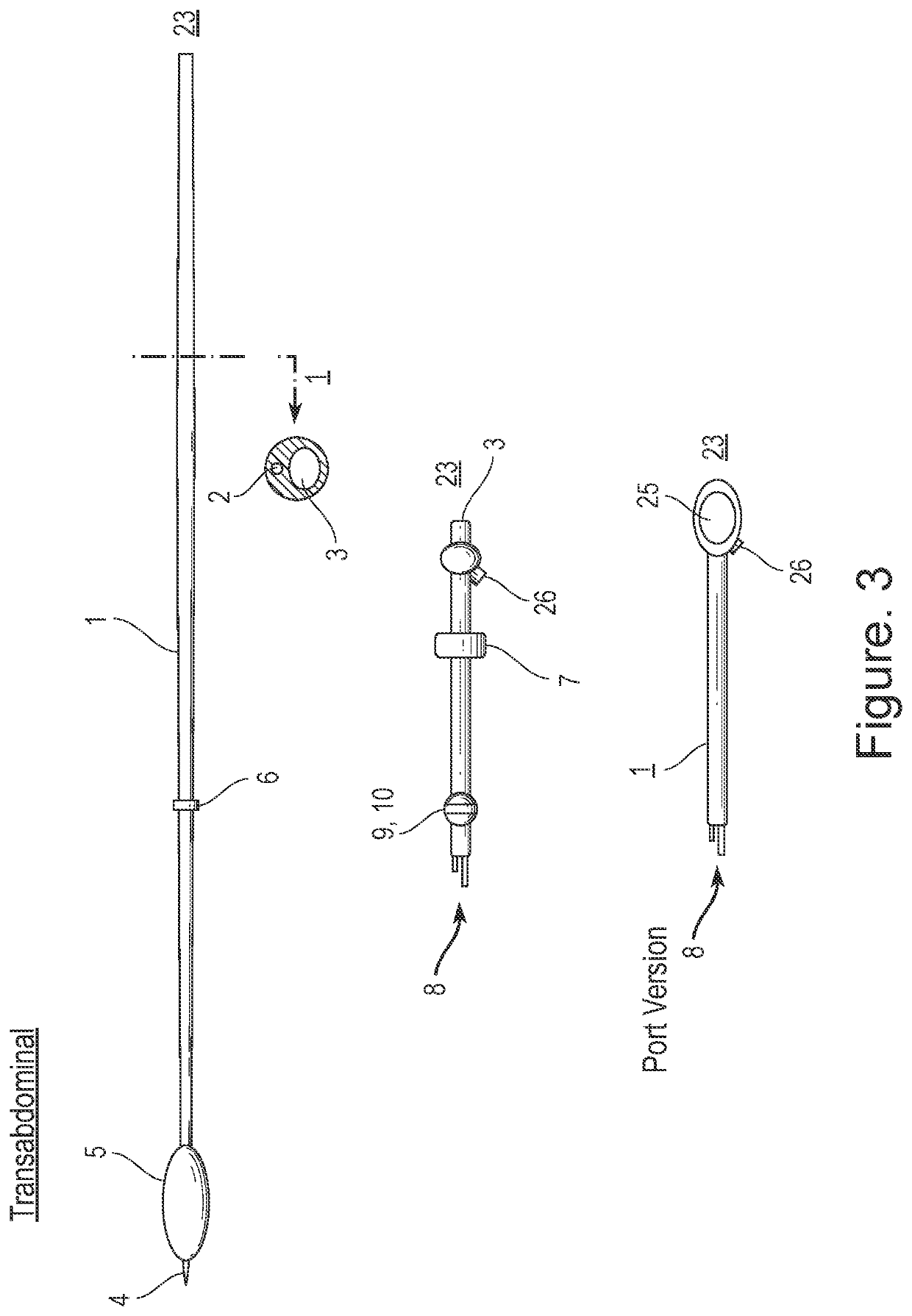 Venous access catheters and methods for portal venous system catheterization