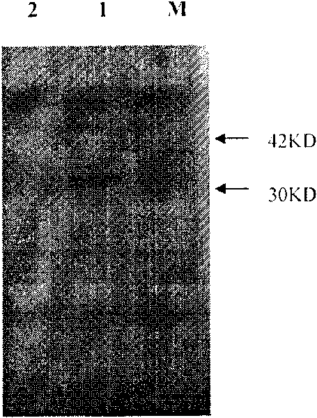 Synthesis of batroxobin gene and preparation method of expression product thereof