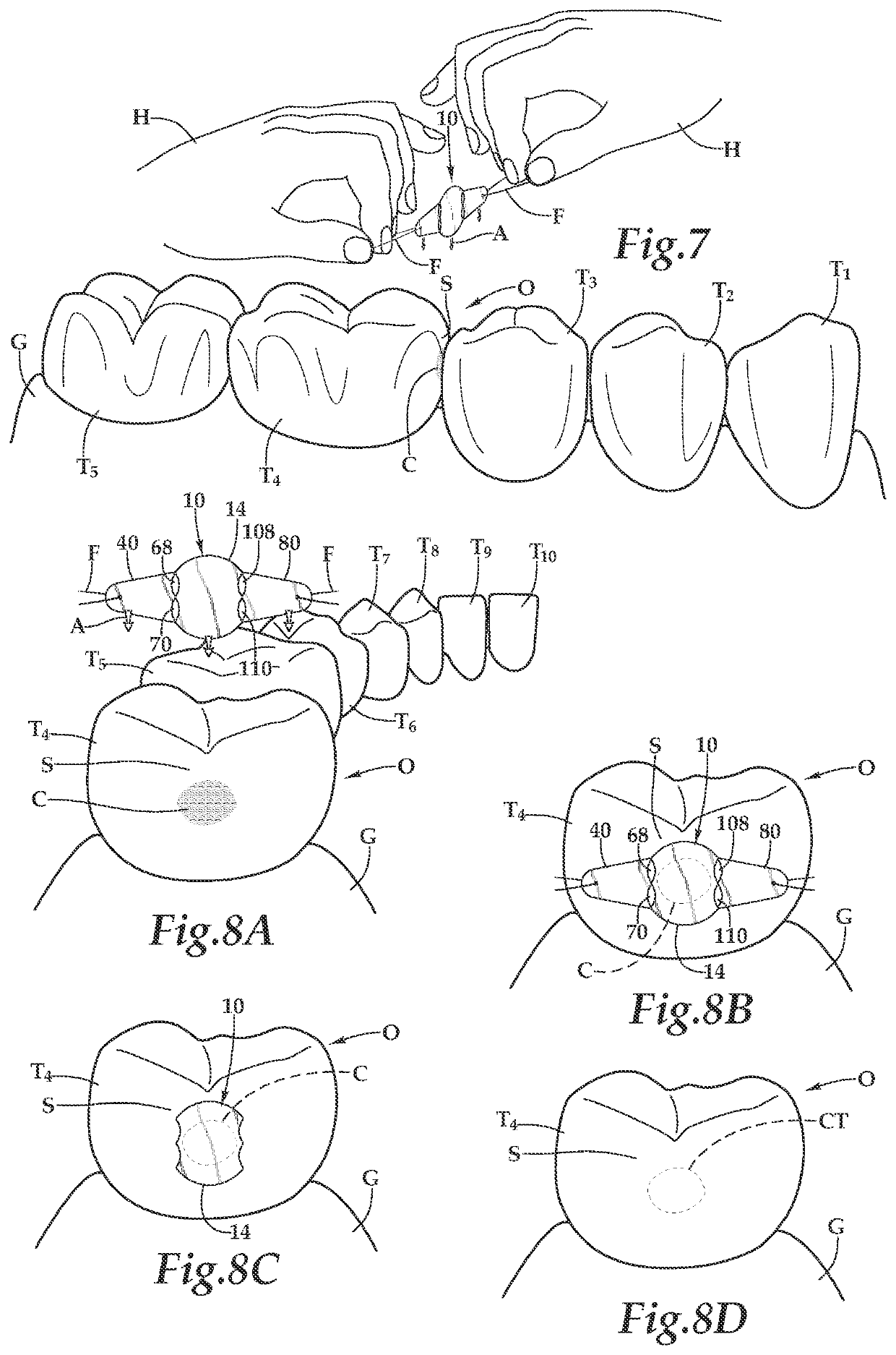 Dental medicament applicator