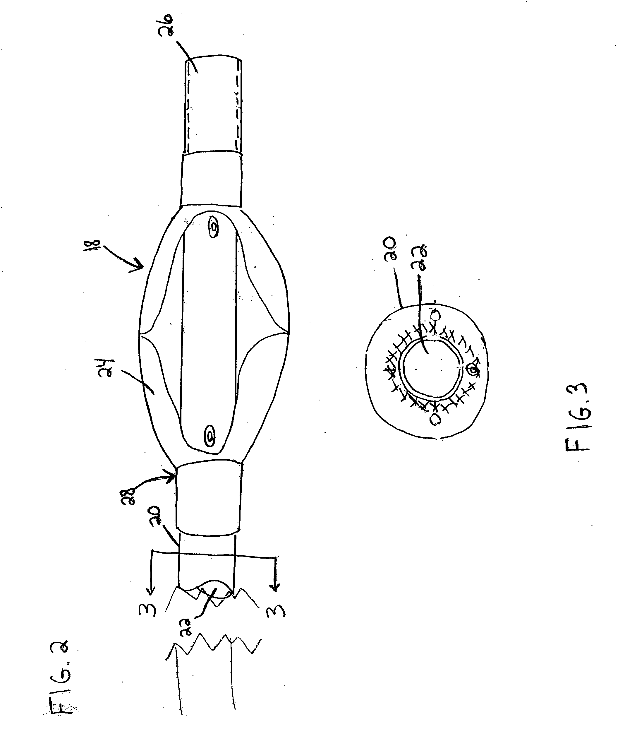 Devices and methods for access through a tissue wall