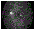 Level set retinal vessel image segmentation method with shape prior being fused