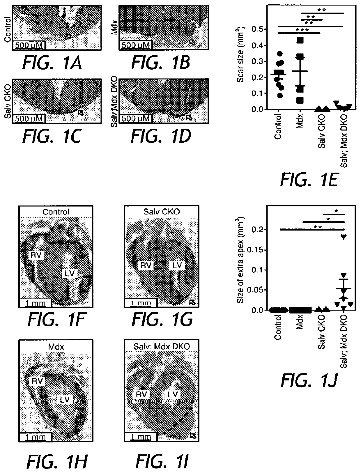 Dystrophin glycoprotein complex sequesters yap to inhibit cardiomyocyte proliferation