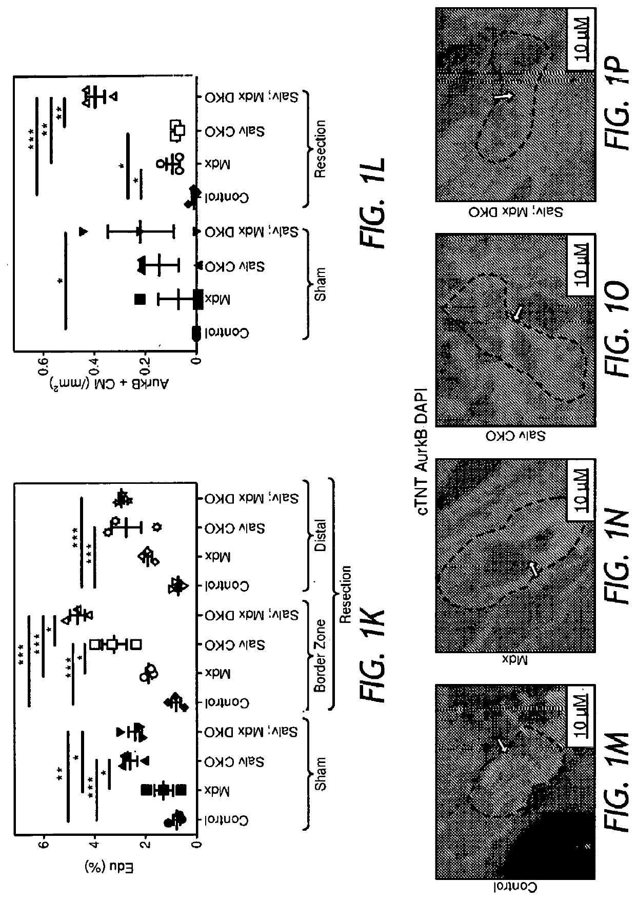 Dystrophin glycoprotein complex sequesters yap to inhibit cardiomyocyte proliferation