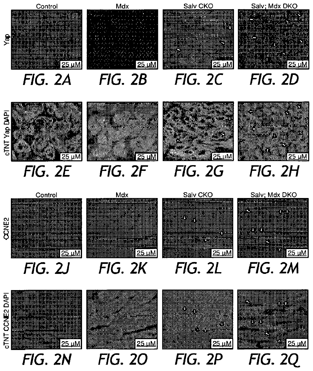 Dystrophin glycoprotein complex sequesters yap to inhibit cardiomyocyte proliferation