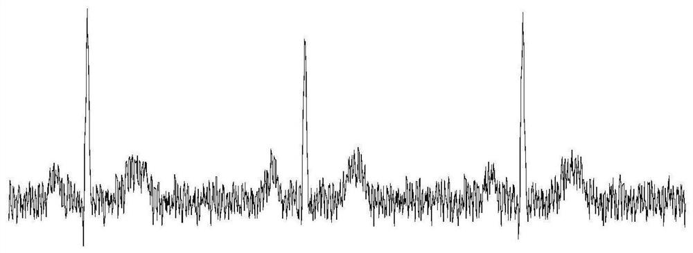 Atrial fibrillation detection device and storage medium