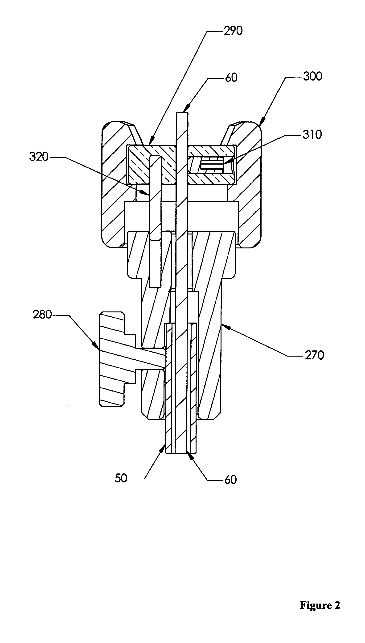 Automated transluminal tissue targeting and anchoring devices and methods