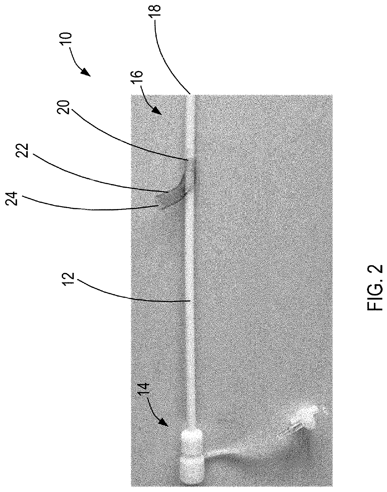 Systems and methods for diverting blood flow in blood vessels