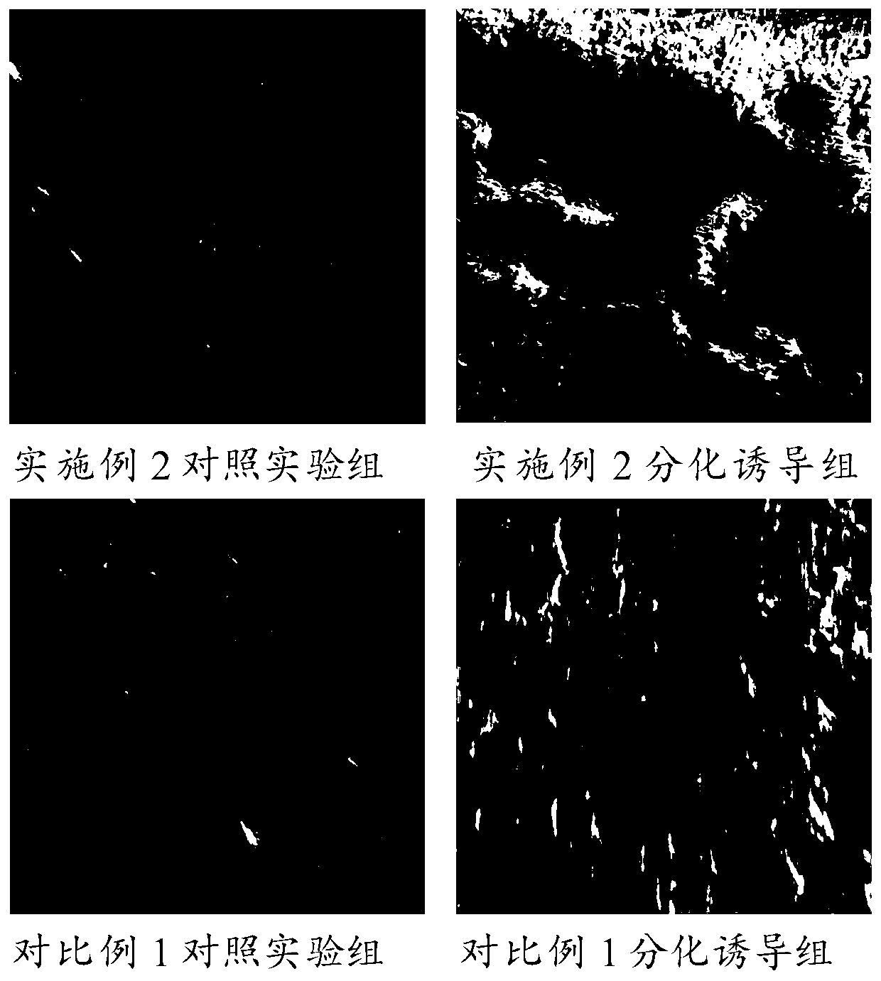 Culture medium for inducing differentiation of dental pulp stem cells into osteoblasts, and preparation method and application of culture midium