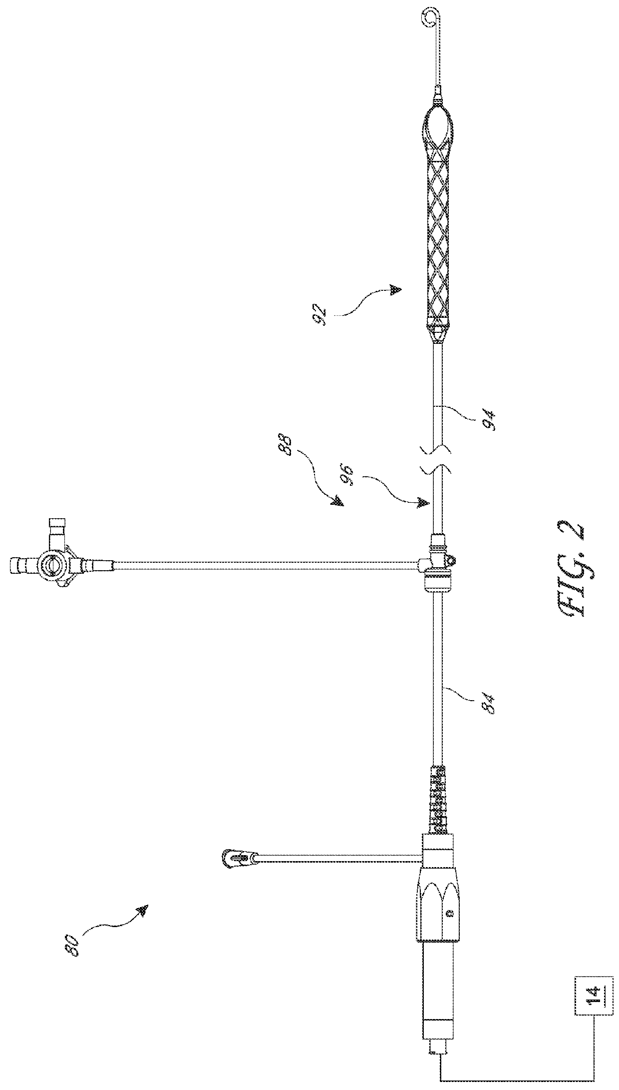 Catheter pump assembly including a stator
