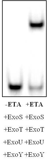 Nucleic acid aptamer eta01 of Pseudomonas aeruginosa exotoxin a and its application