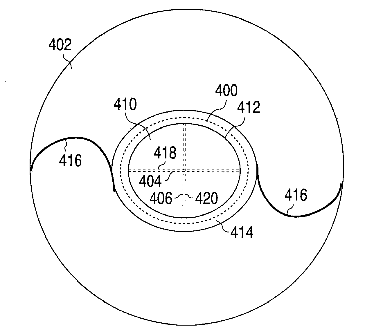 Method and apparatus for creating incisions to improve intraocular lens placement
