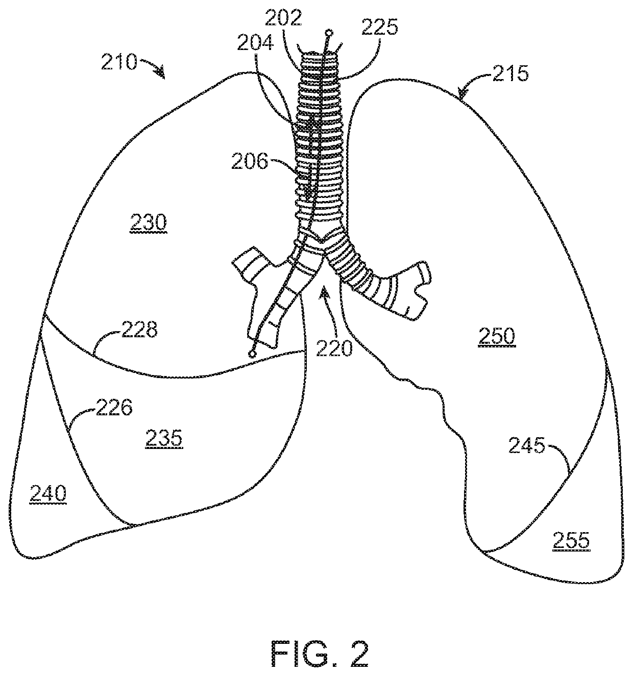 High resistance implanted bronchial isolation devices and methods
