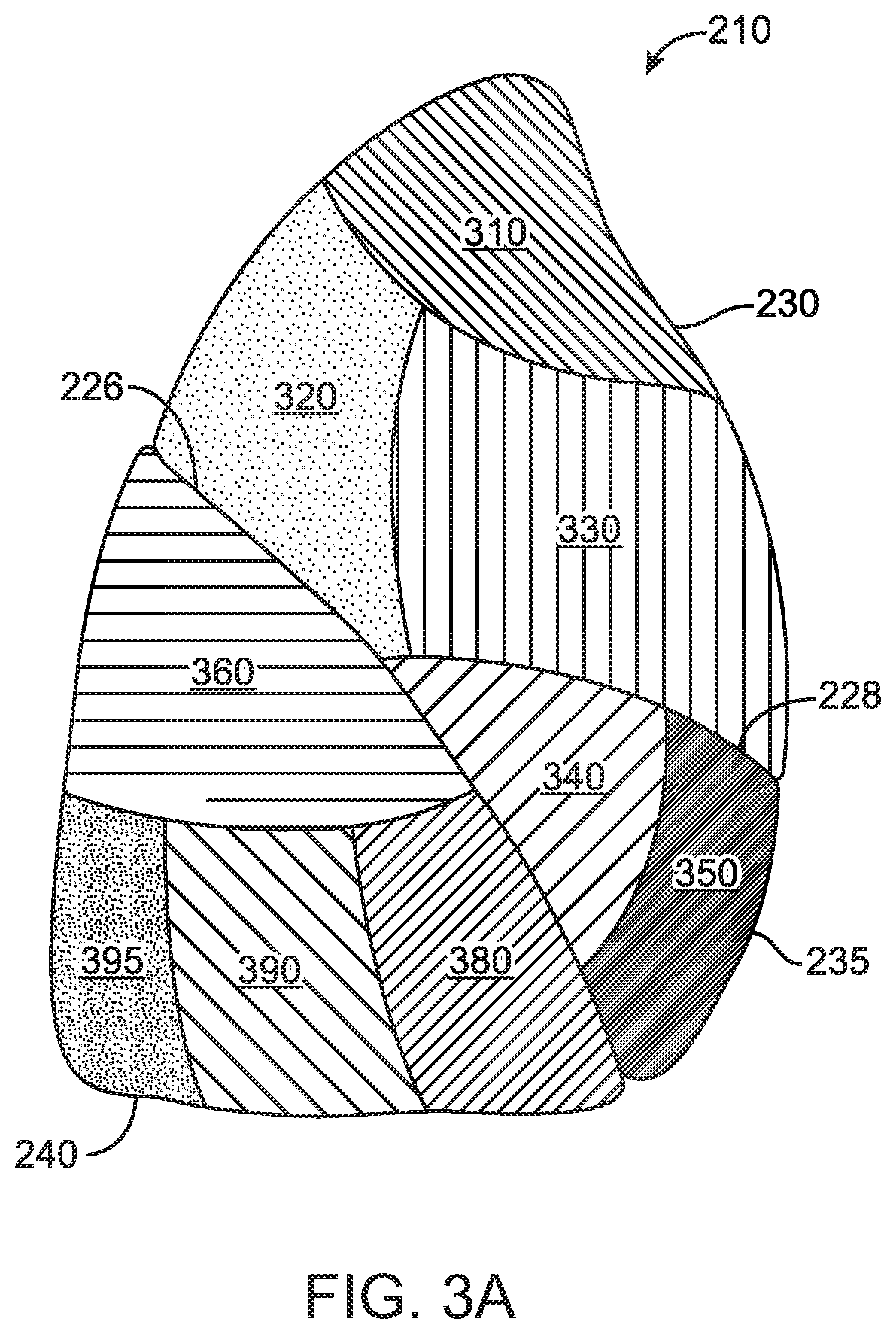 High resistance implanted bronchial isolation devices and methods