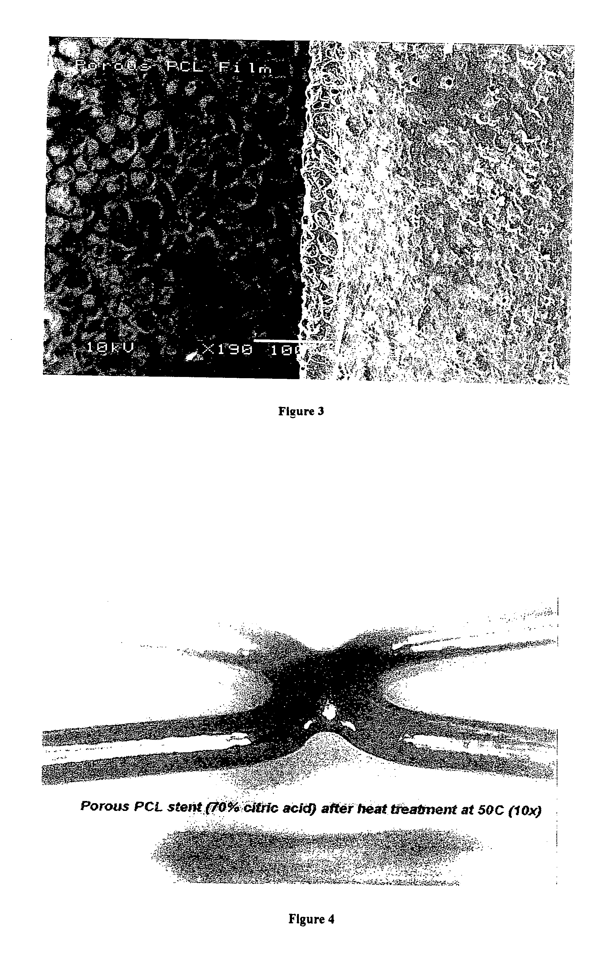 Medical device having a surface including a biologically active agent therein, and methods