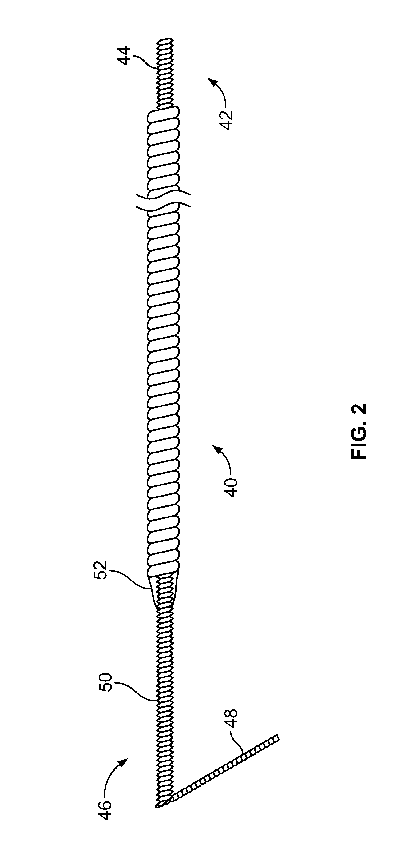 Systems and methods related to the treatment of back pain