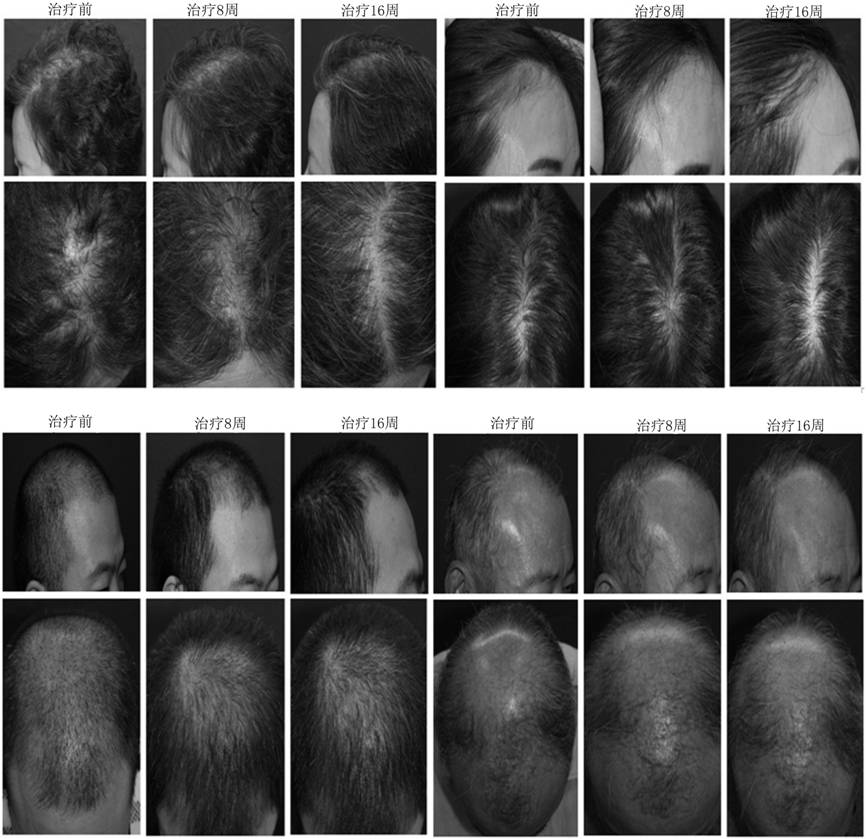 Preparation method and application of stem cell extract