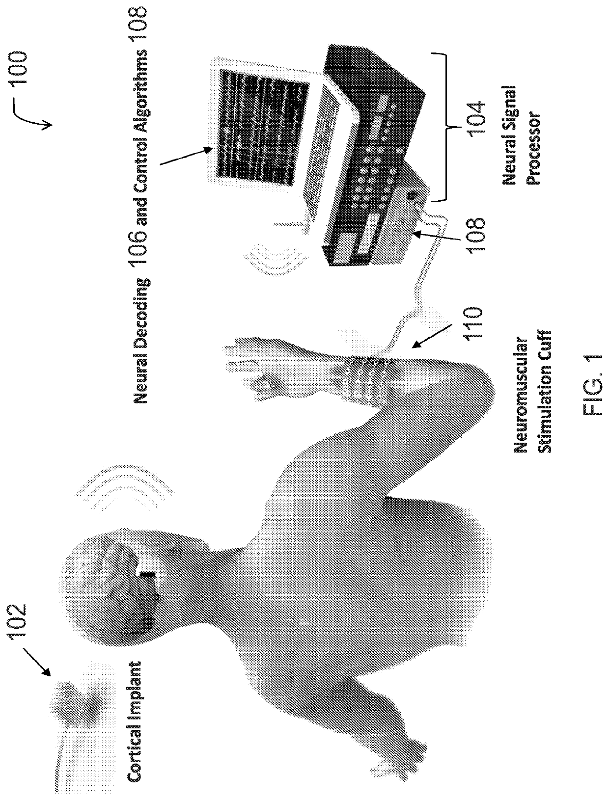 Neural sleeve for neuromuscular stimulation, sensing and recording