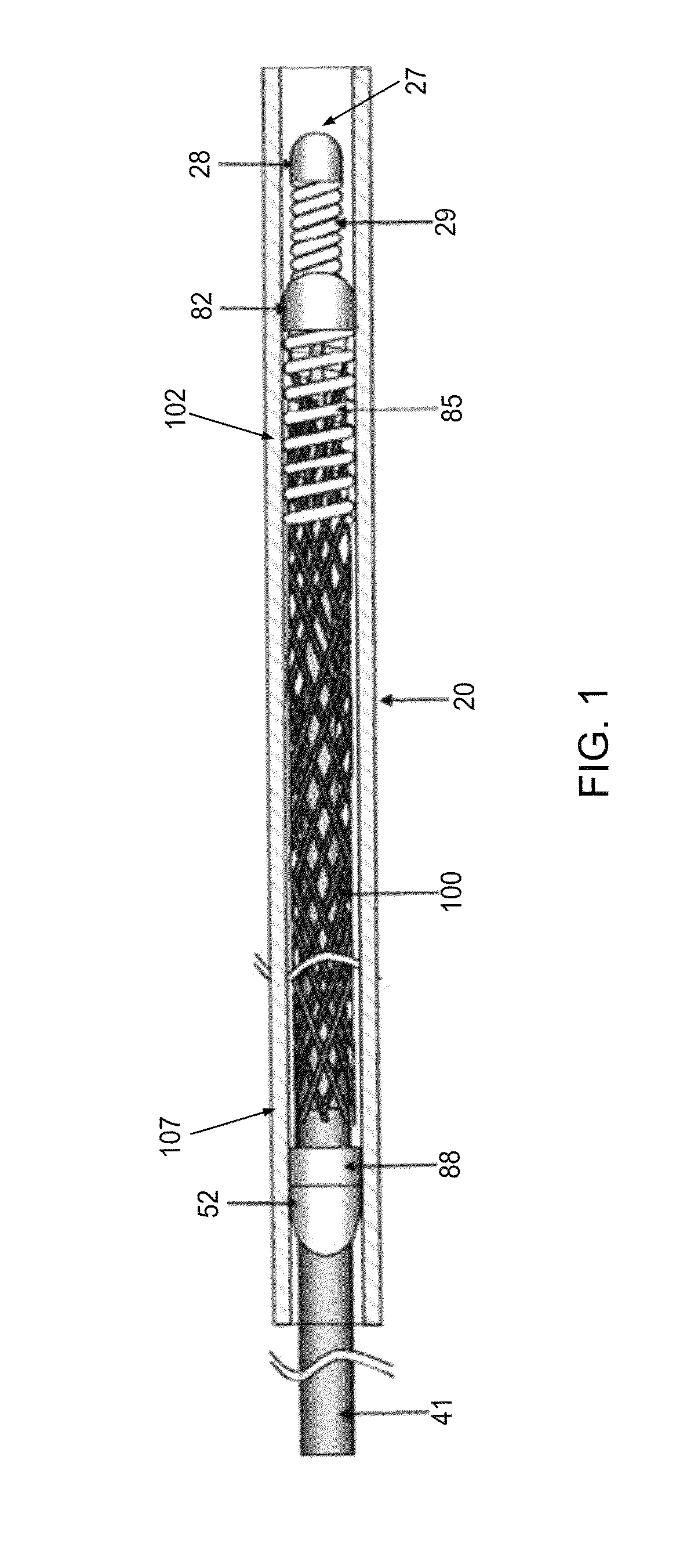 Methods and apparatus for luminal stenting