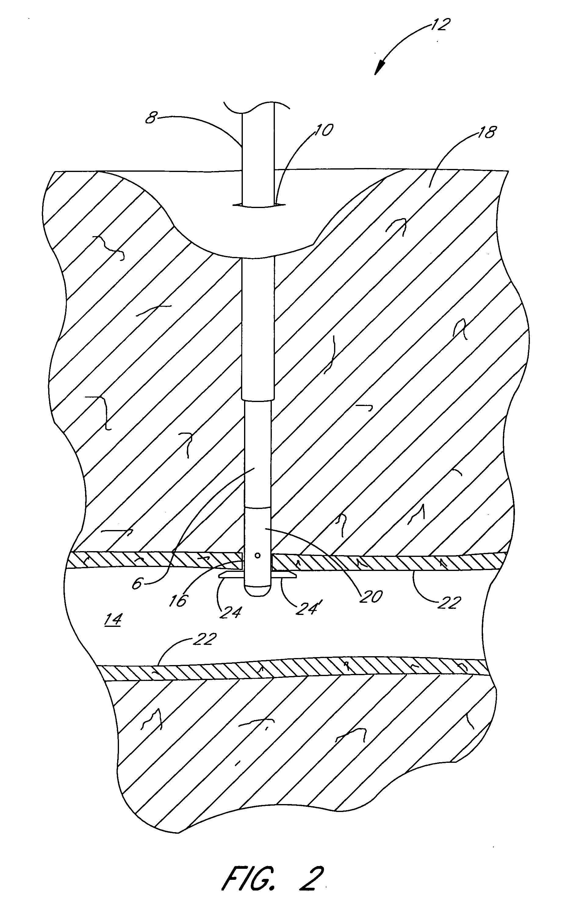 Handle for suturing apparatus