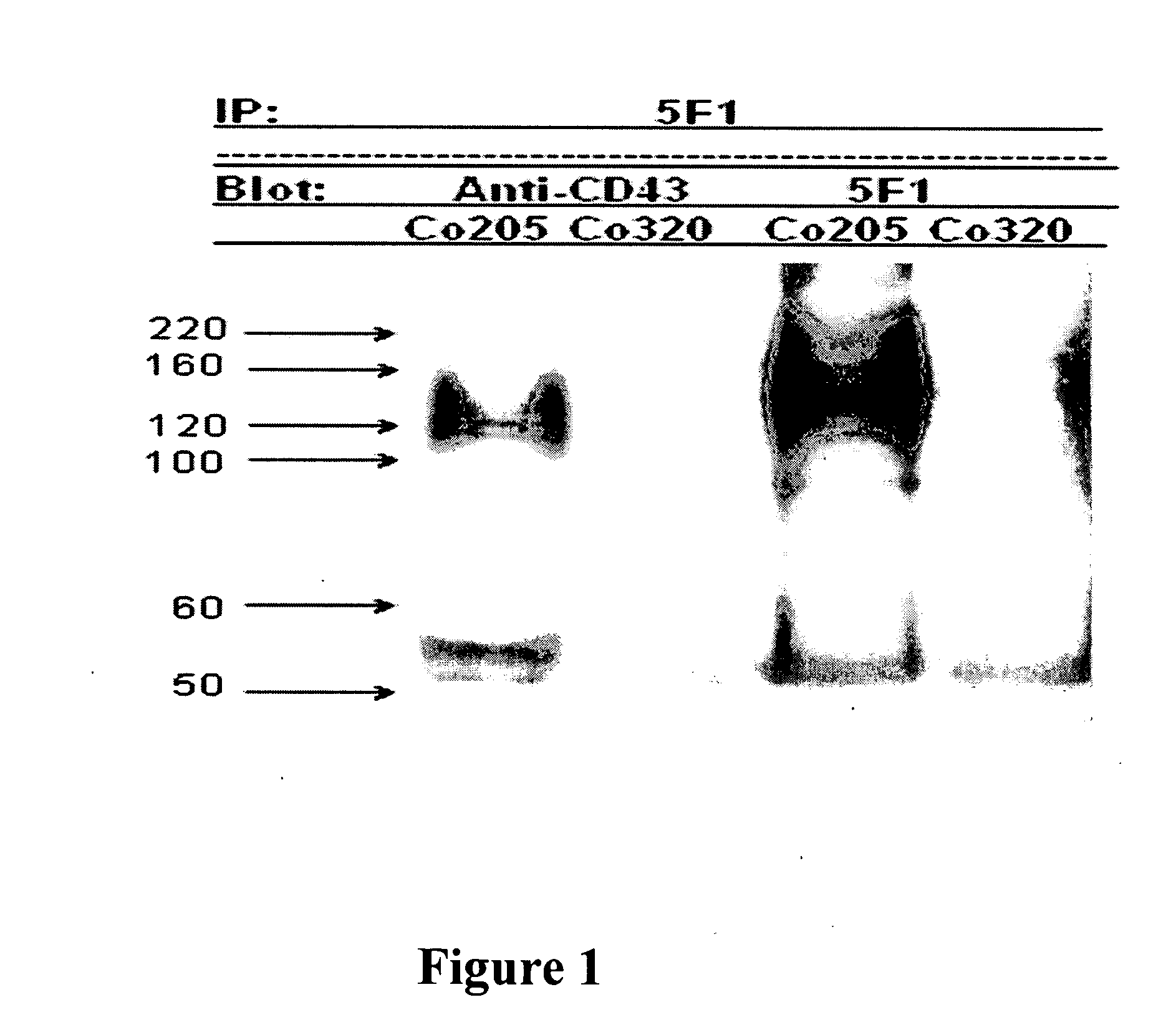 Antibodies recognizing a carbohydrate containing epitope on CD-43 and CEA expressed on cancer cells and methods using same