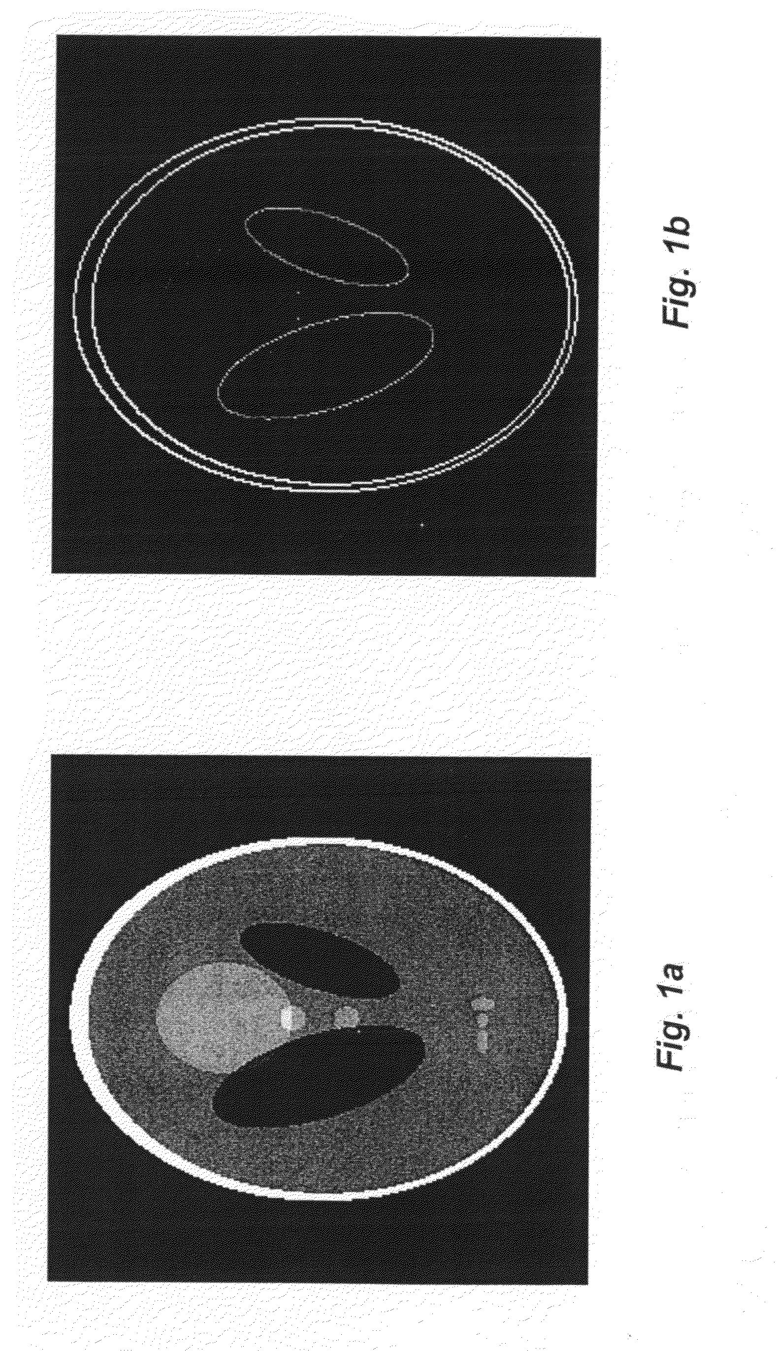 Image Reconstruction From Limited or Incomplete Data