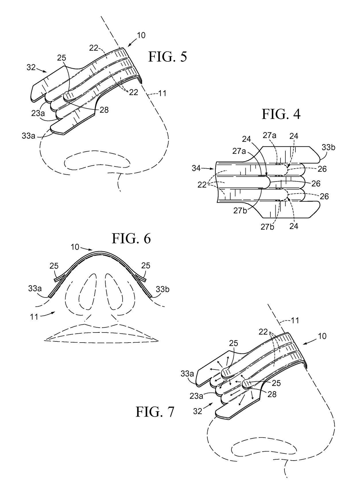 Nasal Dilator With Means To Direct Resilient Properties