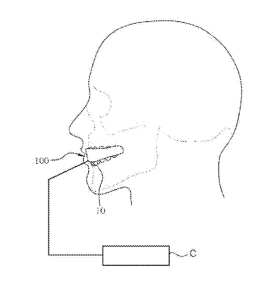 Mouthpiece-type intraoral scanner
