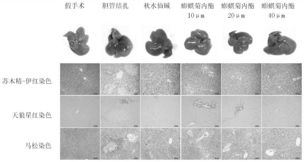 Application of combination of lignan compound and furocoumarin compound to treatment of liver fibrosis